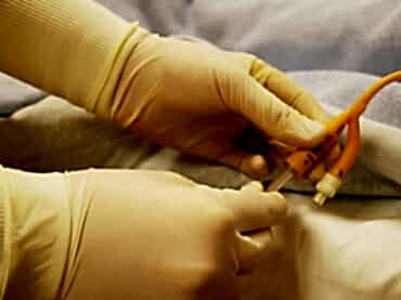 Evde Sonda Takma Hizmeti